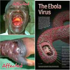 5 con đường Virus Ebola có thể xâm nhập vào Việt Nam